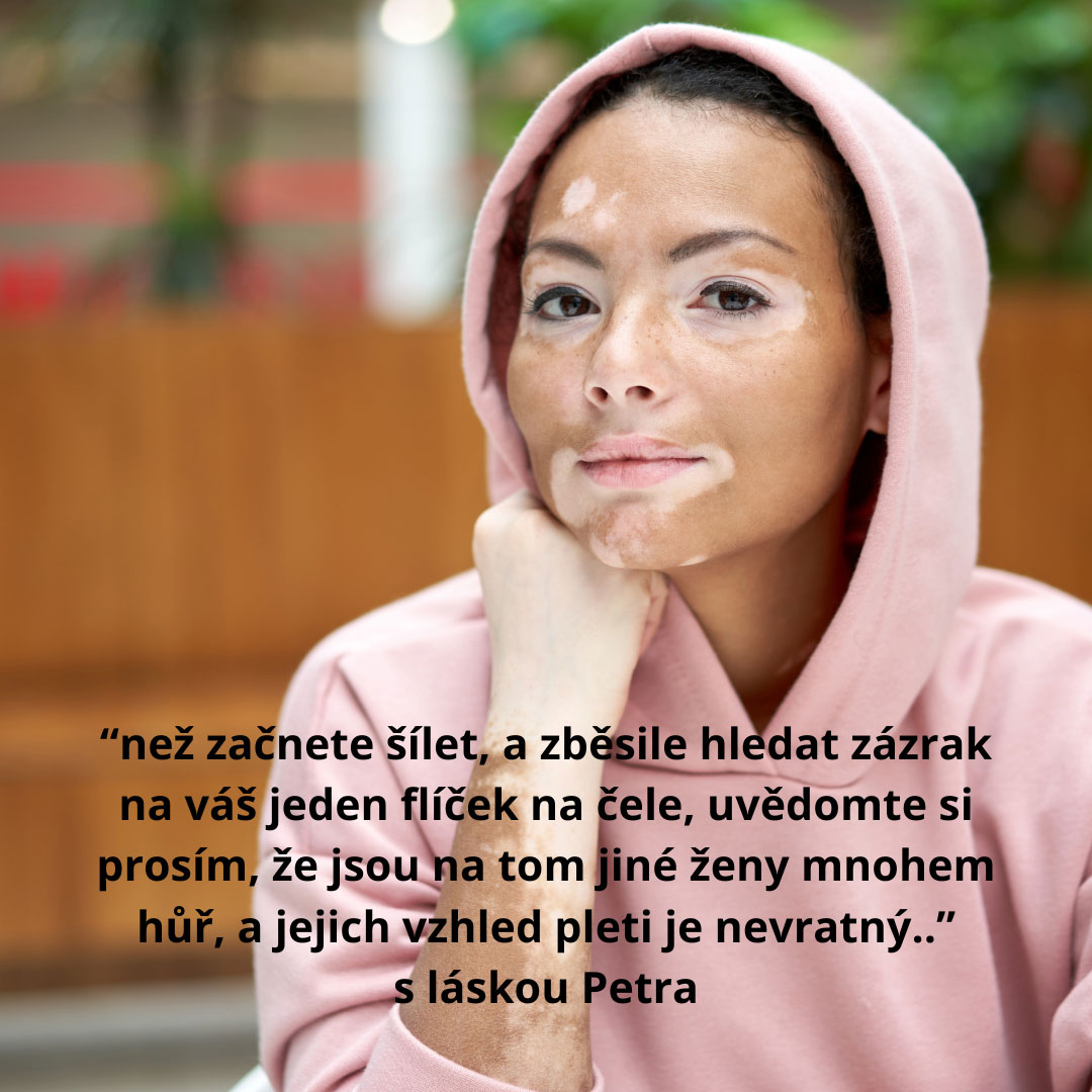 LP – Info pro typ pleti – Pigmentace - Petra Součková E-shop