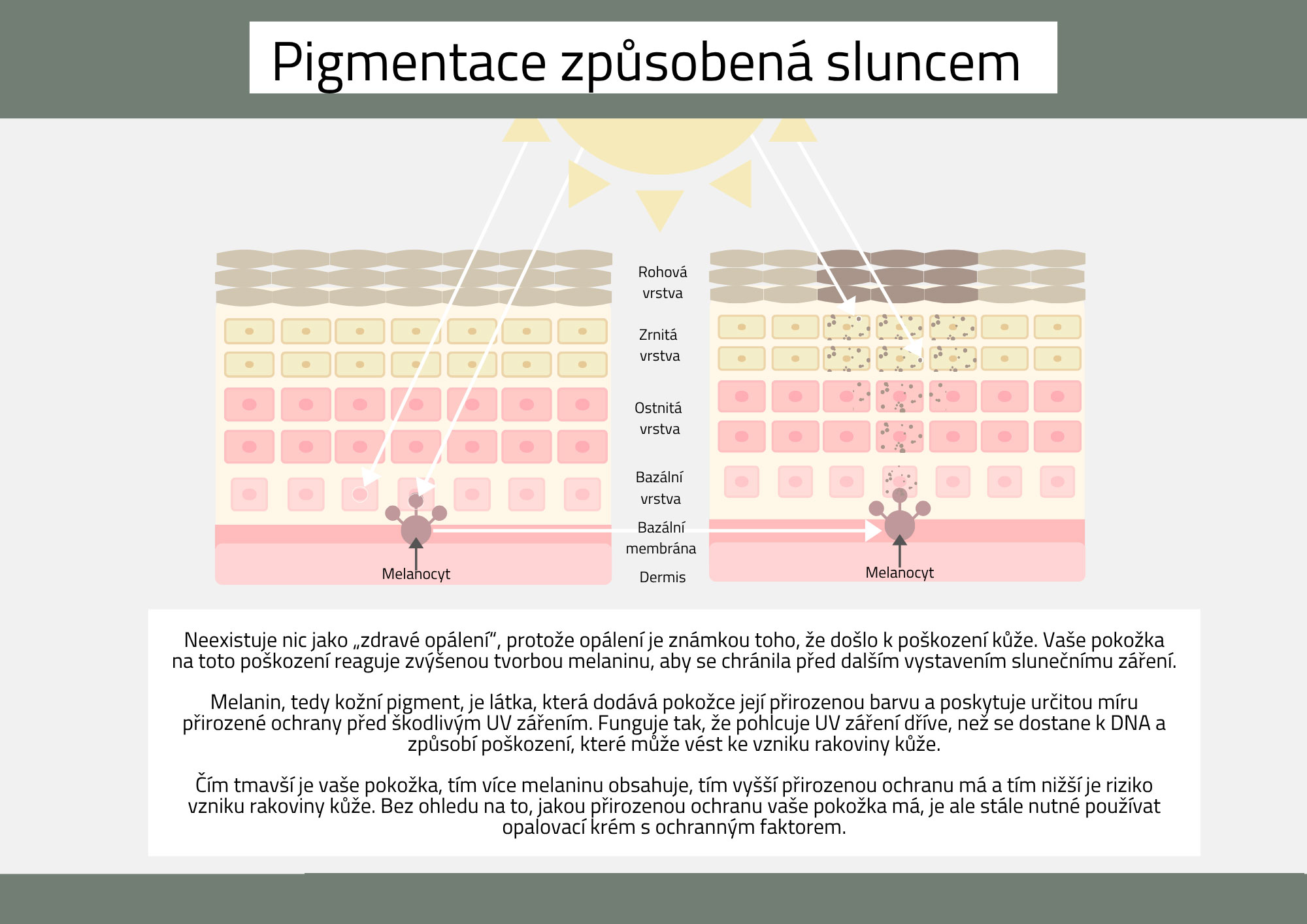 pigmentace způsobená sluncem