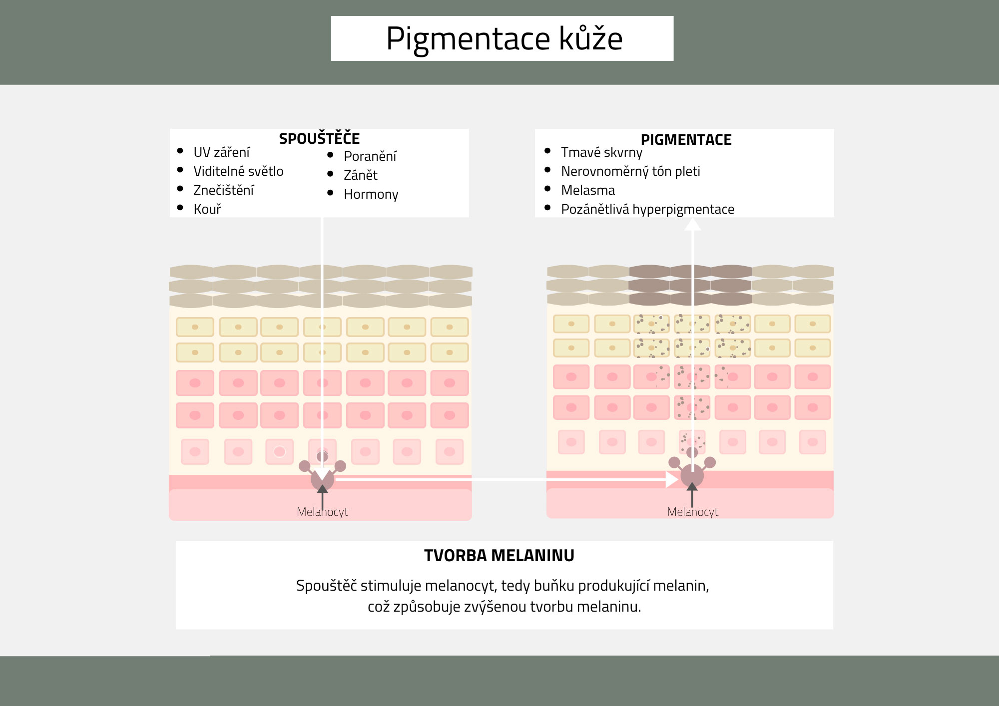 pigmentace kůže