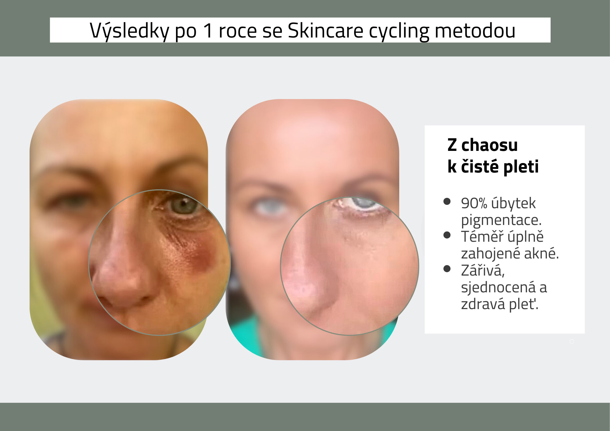 vysledky spravneho cisteni pleti