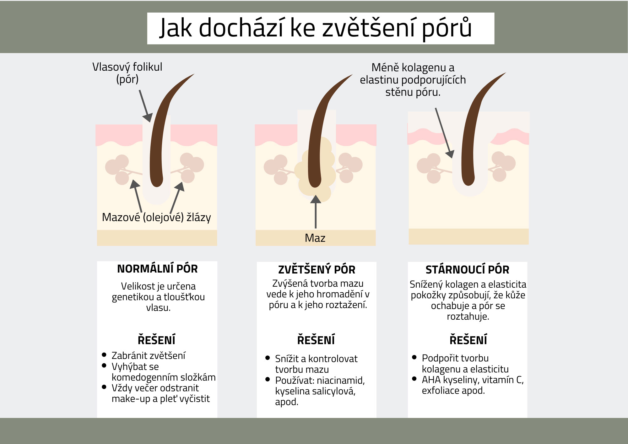 Zvetsene pory a prevence